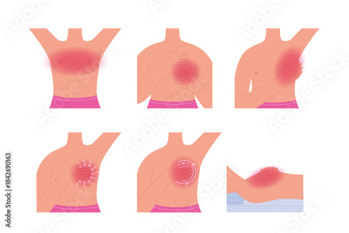 Breast cancer self-exam. Infographic on step-by-step breasts self exploration instruction to prevent oncology. Vector illustration for health care flyers, brochures, web resources.