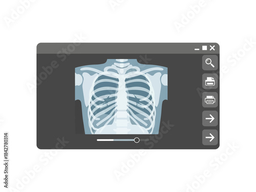 Medical X-Ray Scan Illustration of Chest and Ribcage in Dark Window