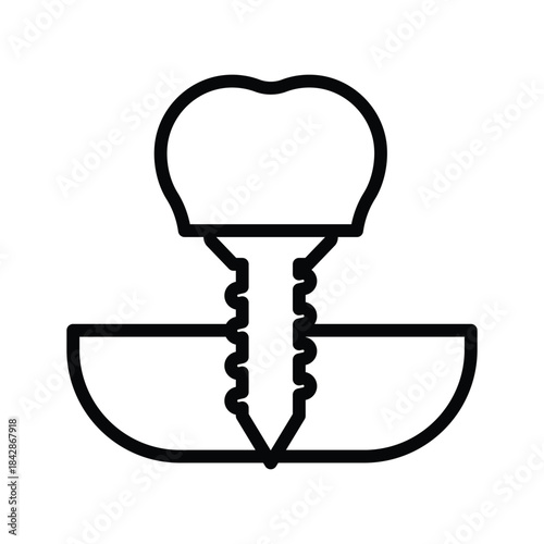 Tooth implant icon