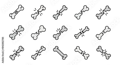 Bone Fracture Illustrations - A Comprehensive Visual Collection.