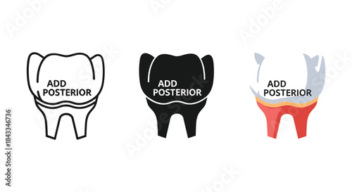 Dental restoration guide with add posterior label