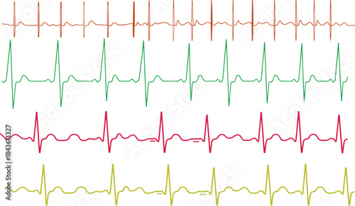 Electrocardiogram heart rate pulse line, medical heartbeat monitor signal, ECG cardiology waveform, healthcare diagnostic technology background, blue digital medical design