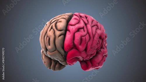 Alzheimer’s Disease Neurological Damage Shown in 3D