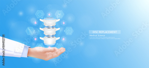 Disc replacement model in doctor hand. Bone spinal joint surrounded by medical icons. Technologies in science health care. Realistic 3D Vector.