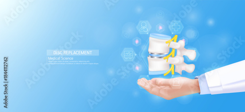 Disc replacement model in doctor hand. Vertebra bone joint surrounded by medical icons. Technologies in science health care. Realistic 3D Vector.