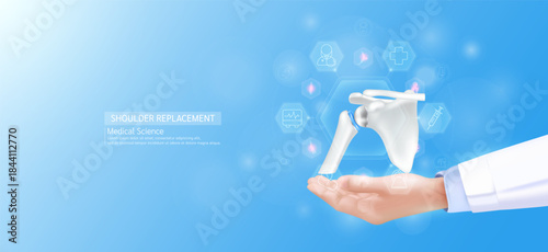 Shoulder replacement model in doctor hand. Joint bone surrounded by medical icons. Technologies in science health care. Realistic 3D Vector.