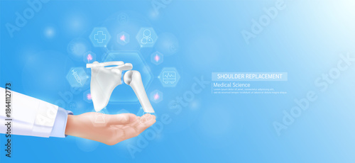 Shoulder replacement model in doctor hand. Bone joint surrounded by medical icons. Technologies in science health care. Realistic 3D Vector.