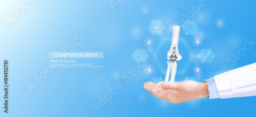 Elbow replacement model in doctor hand. Arm joint bone surrounded by medical icons. Technologies in science health care. Realistic 3D Vector.