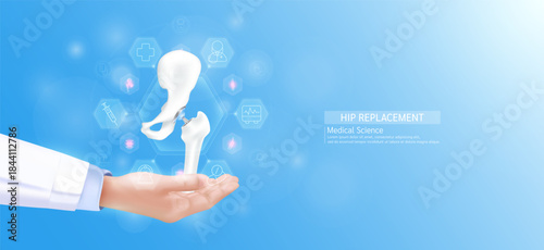 Hip replacement model in doctor hand. Bone joint surrounded by medical icons. Technologies in science health care. Realistic 3D Vector.