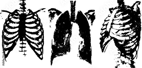 Ribs and lungs anatomy illustration in black and white x-ray style. Vector graphic set for medical and educational purposes.