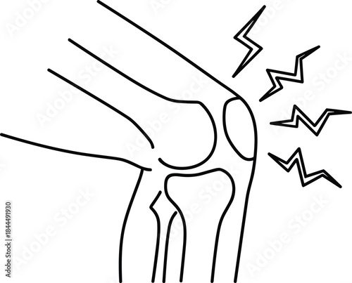 Knee joint pain illustration, medical anatomy line art, orthopedic injury concept, arthritis discomfort, healthcare icon, skeletal leg diagram for diagnosis