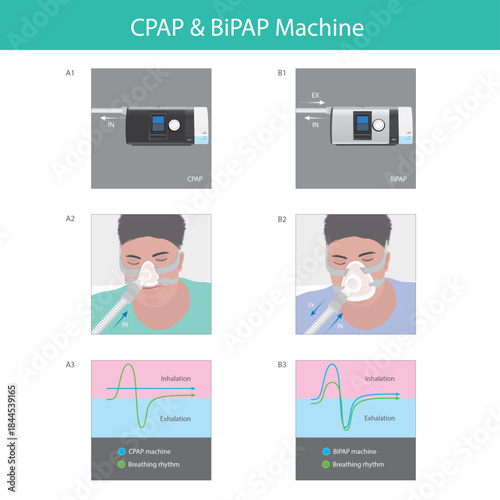 Comparison of CPAP and BiPAP Machine Function