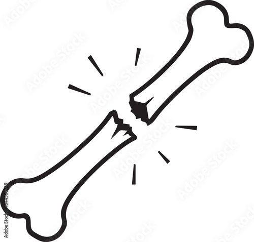 Outline of a long bone with a broken splintered fracture, painful line-art black and white vector illustration