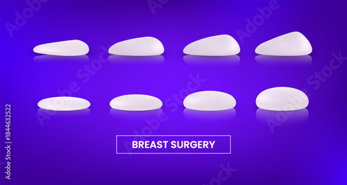 Different types and sizes of silicone breast implants round shape and teardrop shape, vector plastic surgery infographic
