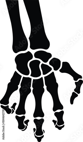 Stylized Black Silhouette of a Human Skeleton Hand and Wrist Bones.