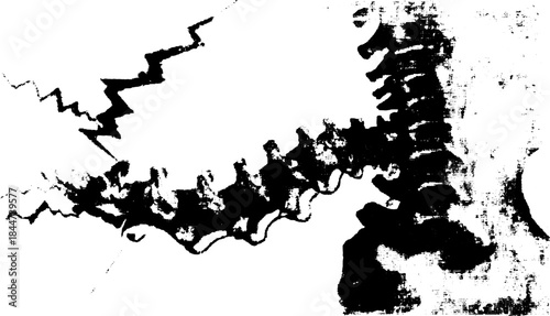 Spine anatomy illustrated in monochrome vector style. Detailed medical graphic showing human vertebrae in a set on a white background.