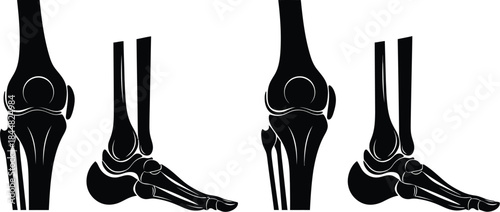 Detailed human knee and leg joints illustration on transparent background silhouette