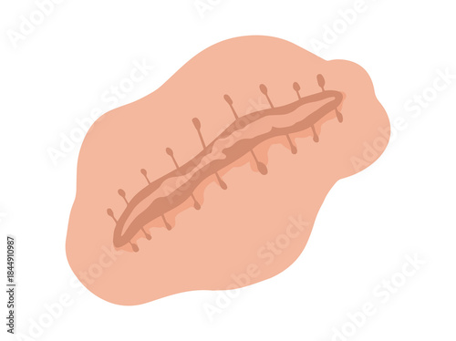 Scar Skin Repaired Tissue Illustration
