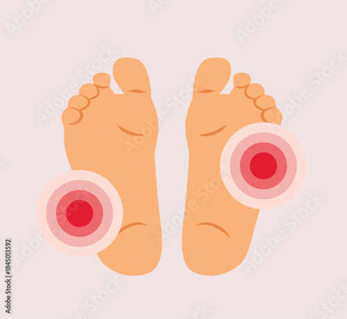 Sore Foot Soles from Walking Vector Illustration. Person having symptoms from rheumatism and arthritis 
