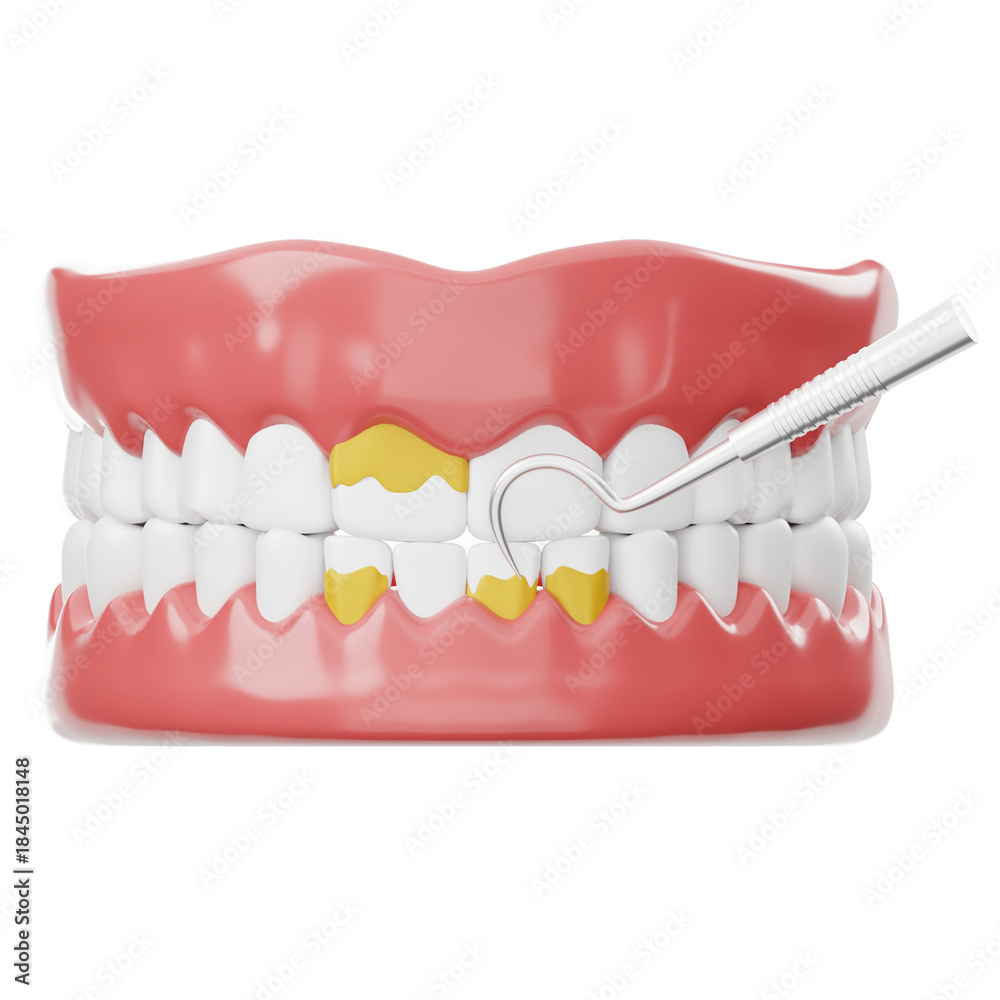 Obraz premium Dental Hygiene with Plaque Removal