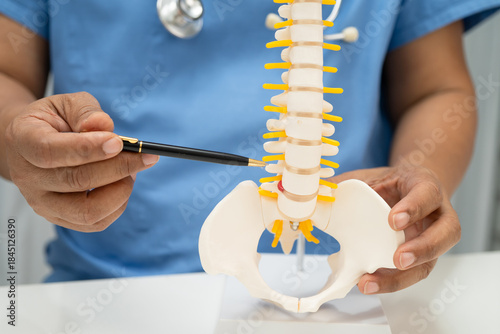 Photos Asian doctor holding spinal nerve and bone model, Lumbar spine displaced herniated disc fragment for treatment medical in the orthopedic department