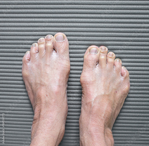 Close up of the feet of an old woman on a gray background