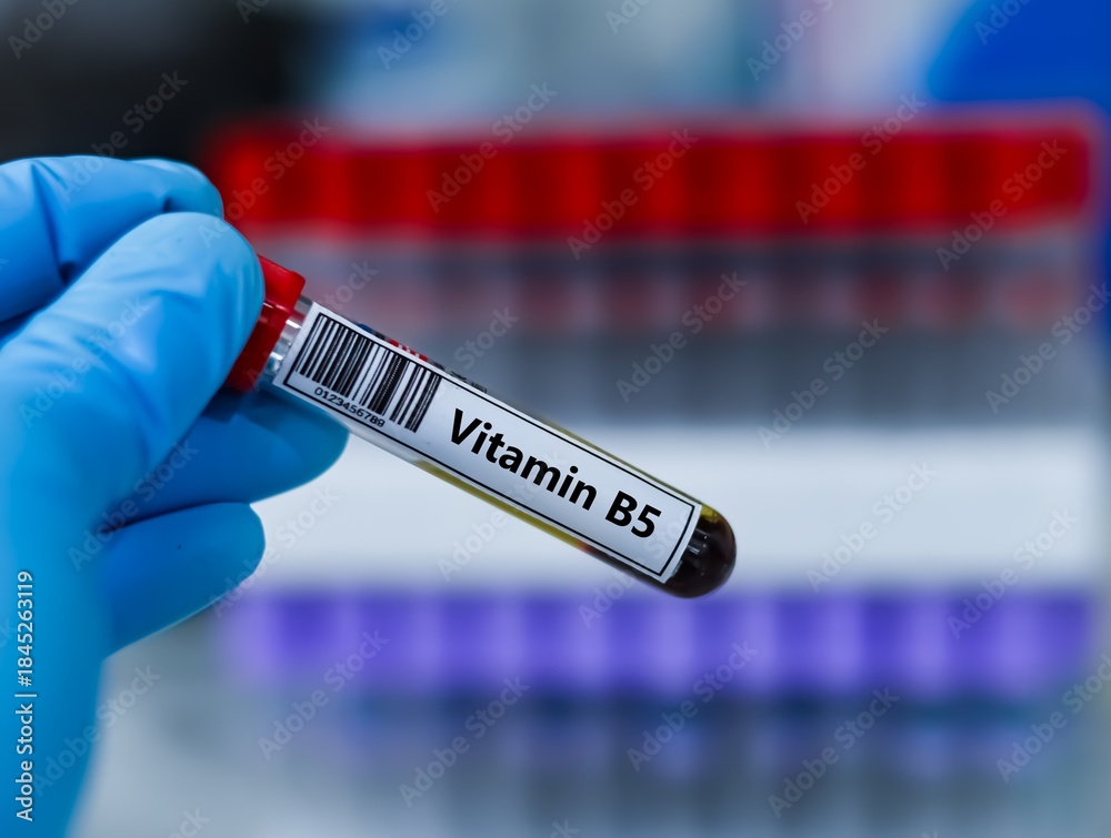 Naklejka premium Blood sample tube for vitamin B5 test analysis.