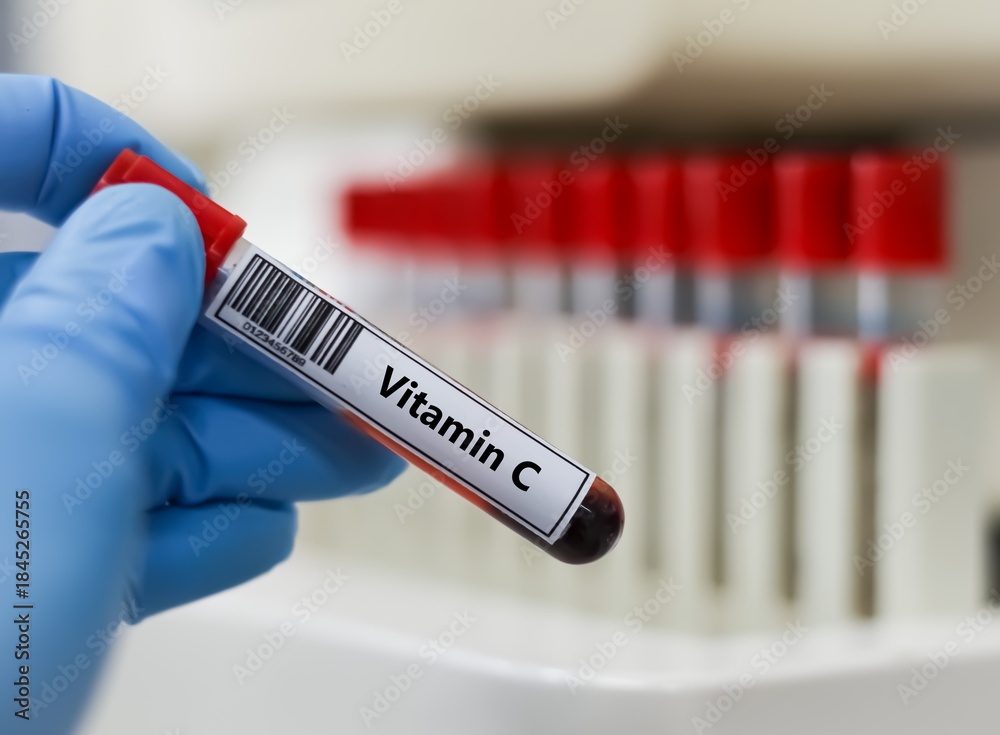 Fototapeta premium Blood sample tube for vitamin C test analysis.