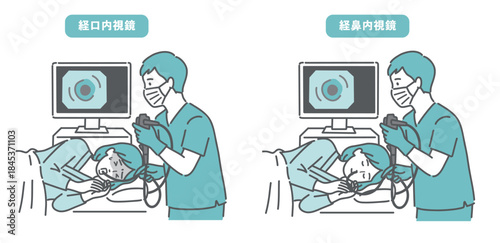 経口内視鏡と経鼻内視鏡の比較イラスト（苦痛と安楽の違い）