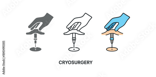 cryosurgery gloved hand gently stretching skin for precise freezing