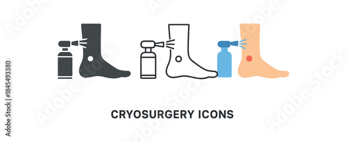 cryosurgery ankle outline with small spot and cryospray cone pointing