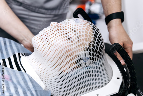 Linear accelerator treatment setup for oncology patient, featuring immobilization mask and medical staff preparing for radiation therapy session in clinical environment
