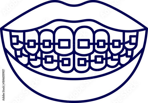 Orthodontic braces on teeth vector icon. Smiling mouth with orthodontic braces on teeth. Dental braces and orthodontic treatment for teeth alignment and smile correction