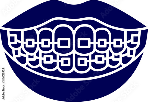  silhouette vector of Orthodontic double braces on teeth. icon of Teeth with braces. concepts of orthodontic treatment. 