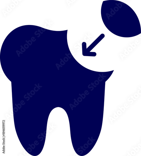 Tooth bonding silhouette vector. Vector of Dental bonding. Dental Filling icon design. dental Filling symbol. Dental bonding process