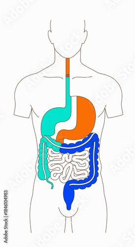 A clear, color-coded medical illustration precisely depicting the human digestive system, highlighting the esophagus, stomach, and intestines, perfect for education.
