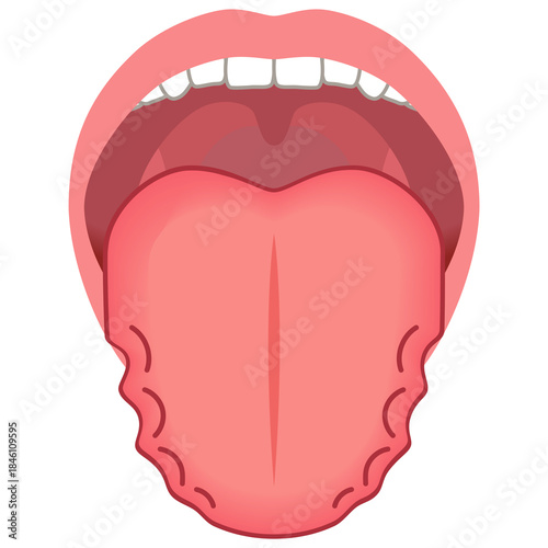 ふちがデコボコしている舌　舌でわかる健康状態　舌診　舌の健康