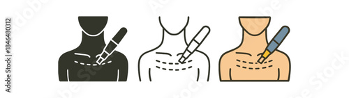 microneedling neck and décolleté outline treated with pen strokes
