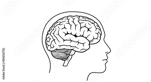 Medical line art illustration showing a cross-section of a human head with the brain visible inside for educational purposes.