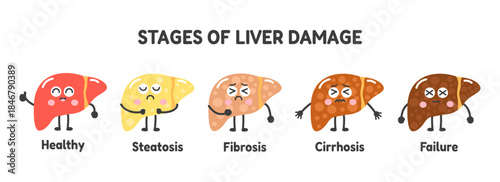 Stages of liver damage illustration. Characters depicting healthy, steatosis, fibrosis, cirrhosis, and failure. Medical concept. Cute cartoon vector illustration.