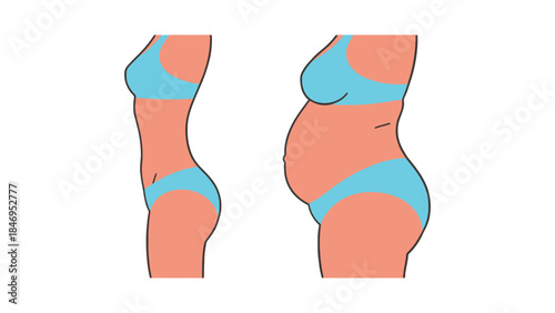 Illustration of woman's body before and after pregnancy