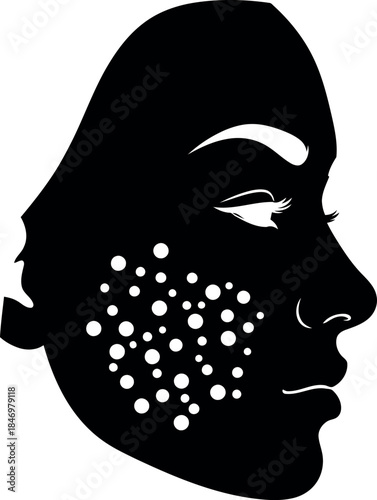 Silhouette of a woman s face with acne spots on her cheek