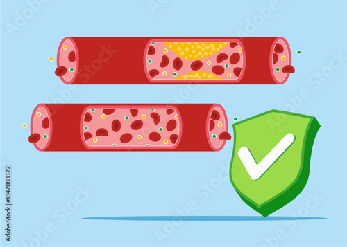 Human blood vessels with green shield check mark. System in normal. Veins from cholesterol and blood cells clot. Cardiovascular system, cardiology, medical examination topics. Flat vector illustration
