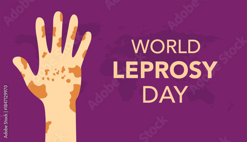Vector illustration on the theme of World Leprosy Eradication or Hansen's disease day observed each year on last Sunday of January across the globe