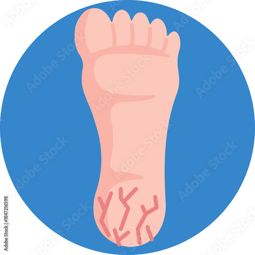Symbolizes diabetic foot health, including regular checks for wounds, ulcers, or circulation issues.