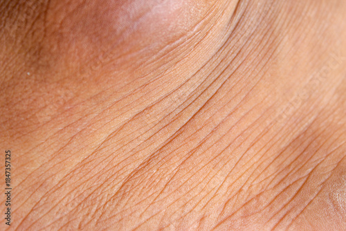 Wrinkled skin texture on men's legs