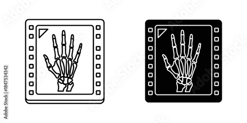 X-ray images of a hand