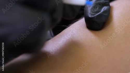 A close-up of a cosmetologist removes hair using electrodippilation, the process of electroepilation on a young girl's hand. Modern hair removal in a beauty salon.