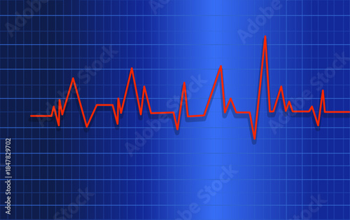Red heartbeat line graph on blue grid background representing medical ecg or vital signs monitoring