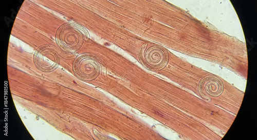Macro photo of Trichinella spiralis parasites between meat fibers, seen under a microscope